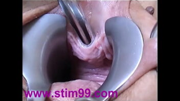 How To Insert A Urethral Sound